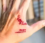 Bị chó cắn, việc đơn giản này có thể cứu sống bạn